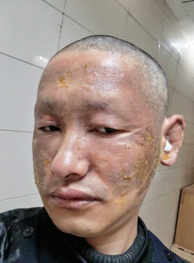 探索星光的奧秘，明星天臉重塑魅力的奇跡之旅