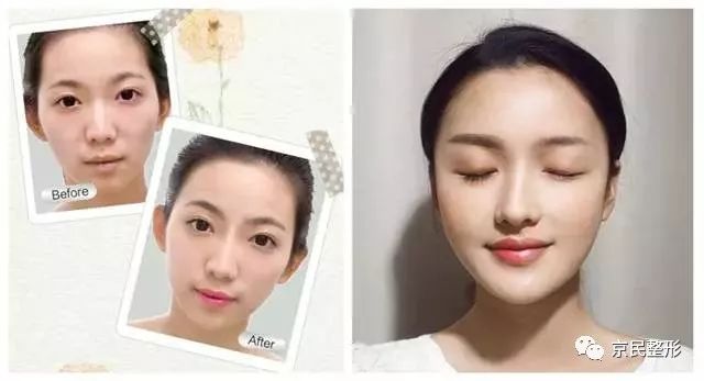 最新眉部美容技術(shù)，塑造完美眉型，瞬間驚艷全場的美顏秘訣 ???