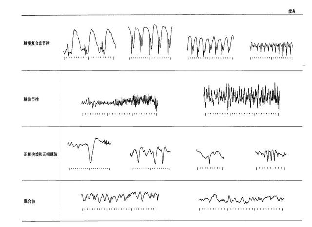 視頻腦電圖之旅，愛與陪伴的溫馨故事探尋價格揭秘