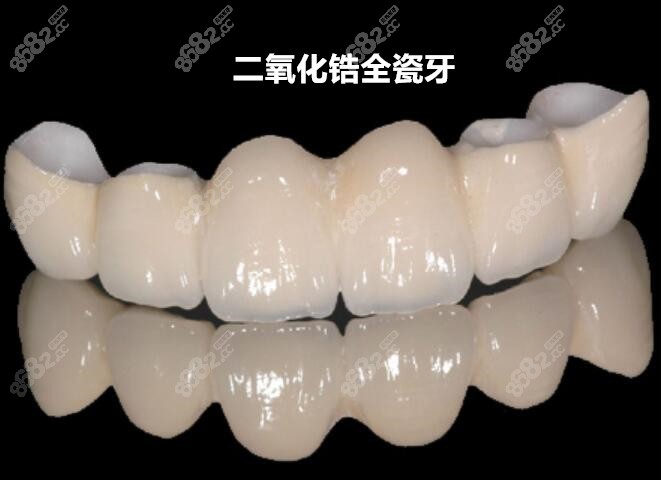 二氧化鋁全瓷牙價格變動與追求自信成就感的關(guān)聯(lián)探索