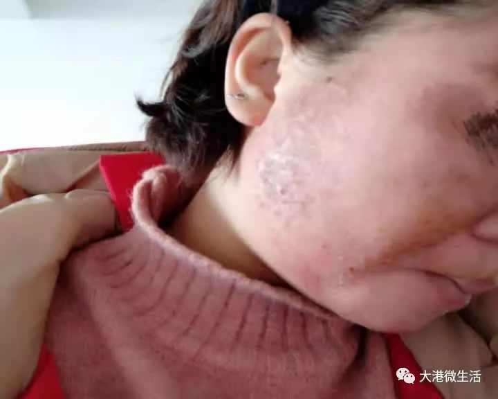 最新寶顏術(shù)，探索美容新境界的奧秘